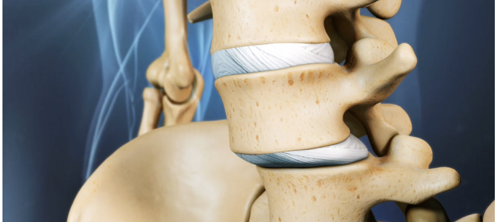 » Fisioterapia para la inestabilidad lumbar crónica: prevención y ...