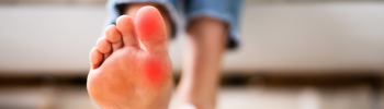 Cómo mejorar la alineación del pie con ejercicios de fisioterapia. Cómo mejorar la alineación del pie con ejercicios de fisioterapia.