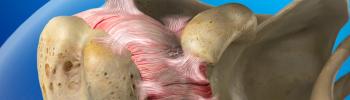 capsulitis adhesiva del hombro capsulitis adhesiva del hombro