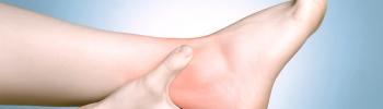 ¿Cómo mejorar tú esguince de tobillo? - FisioClinics Palma ¿Cómo mejorar tú esguince de tobillo? - FisioClinics Palma