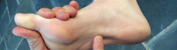 Tratamiento fisioterapéutico para la fascitis plantar en FIsioClinics Palma  Tratamiento fisioterapéutico para la fascitis plantar en FIsioClinics Palma