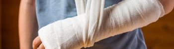 Abordaje desde la fisioterapia para las fracturas óseas - FisioClinics Palma Abordaje desde la fisioterapia para las fracturas óseas - FisioClinics Palma