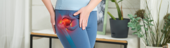 Fortalecimiento muscular para prevenir la trocanteritis Fortalecimiento muscular para prevenir la trocanteritis