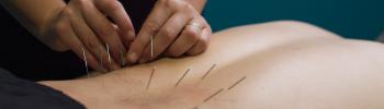 Síndrome del dolor miofascial y su tratamiento en FisioClinics Palma Síndrome del dolor miofascial y su tratamiento en FisioClinics Palma