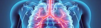Síndrome de Tietze o costocondritis ¿por qué nos duelen las costillas? Síndrome de Tietze o costocondritis ¿por qué nos duelen las costillas?
