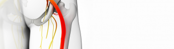 Fisioterapia para el síndrome del piramidal en FisioClinics Palma Fisioterapia para el síndrome del piramidal en FisioClinics Palma