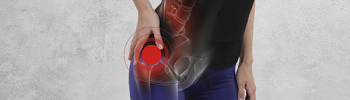 Bursitis trocantérea o Trocanteritis - Qué es y su tratamiento en FisioClinics Palma  Bursitis trocantérea o Trocanteritis - Qué es y su tratamiento en FisioClinics Palma