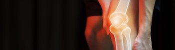 Diferencias entre Condromalacia Rotuliana y Otros Problemas de Rodilla Diferencias entre Condromalacia Rotuliana y Otros Problemas de Rodilla