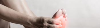 Fascitis plantar en trabajadores: 6 claves para cuidar tus pies durante largas jornadas