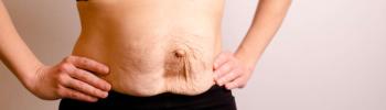Fisioterapia y pilates para la diástasis abdominal postparto Fisioterapia y pilates para la diástasis abdominal postparto