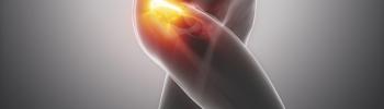 Osteopatía de pubis o pubalgia. Síntomas y causas Osteopatía de pubis o pubalgia. Síntomas y causas