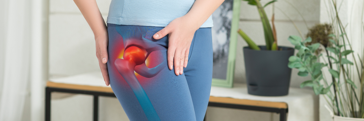 Fortalecimiento muscular para prevenir la trocanteritis