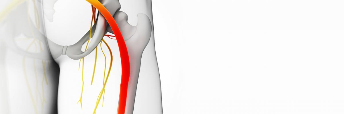 Fisioterapia para el síndrome del piramidal en FisioClinics Palma